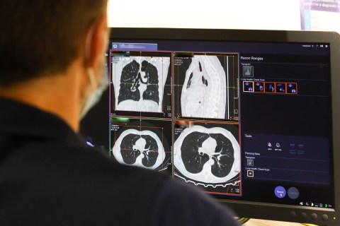 A member of staff looks at the results of a lung scan